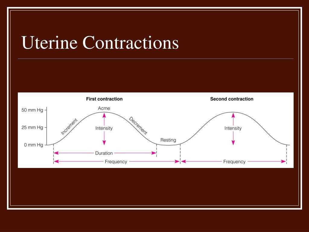 Non-graphic medical illustration explaining uterine contractions during medication abortion